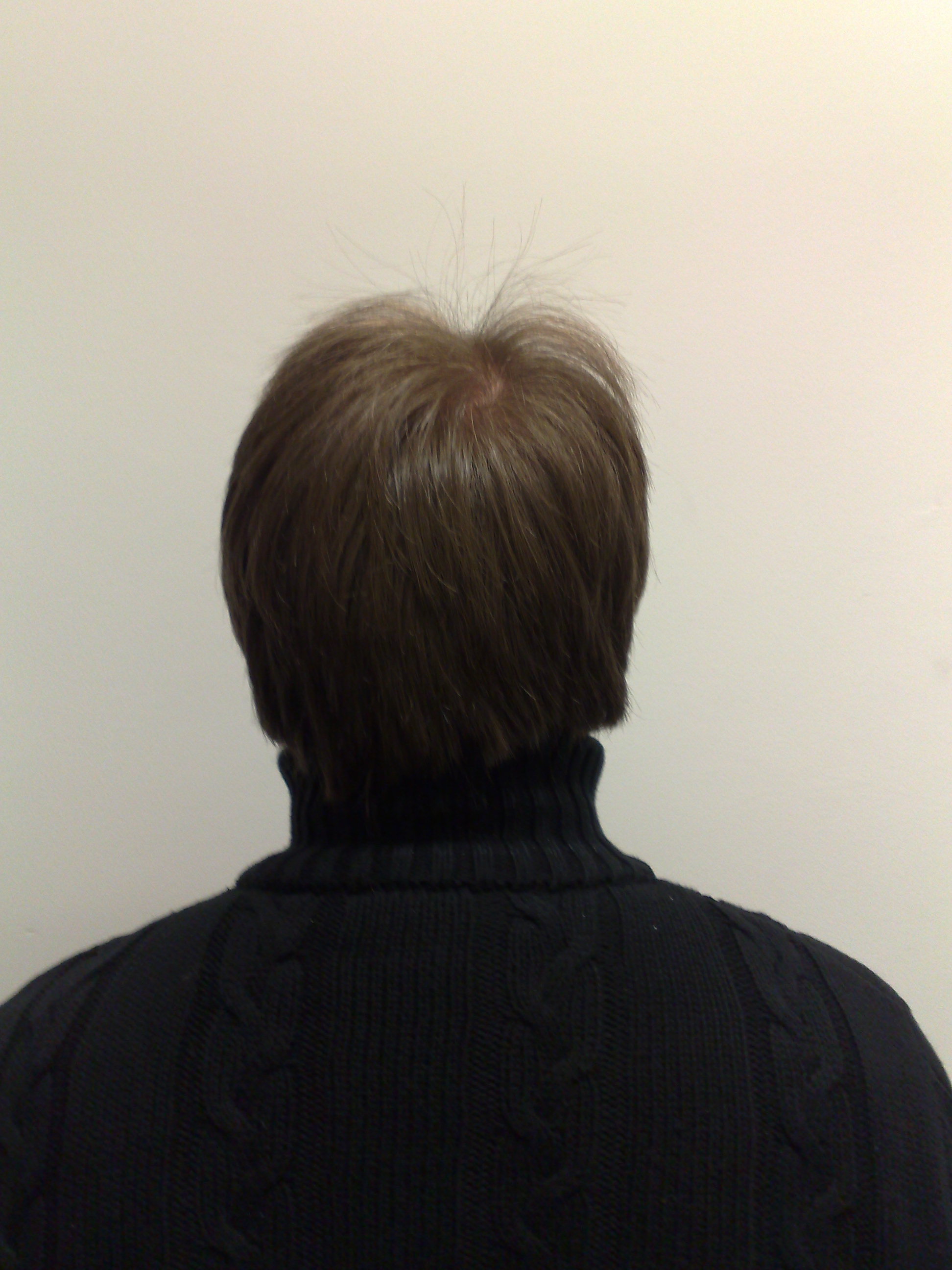 Vorher Hinten Vorher Hinten