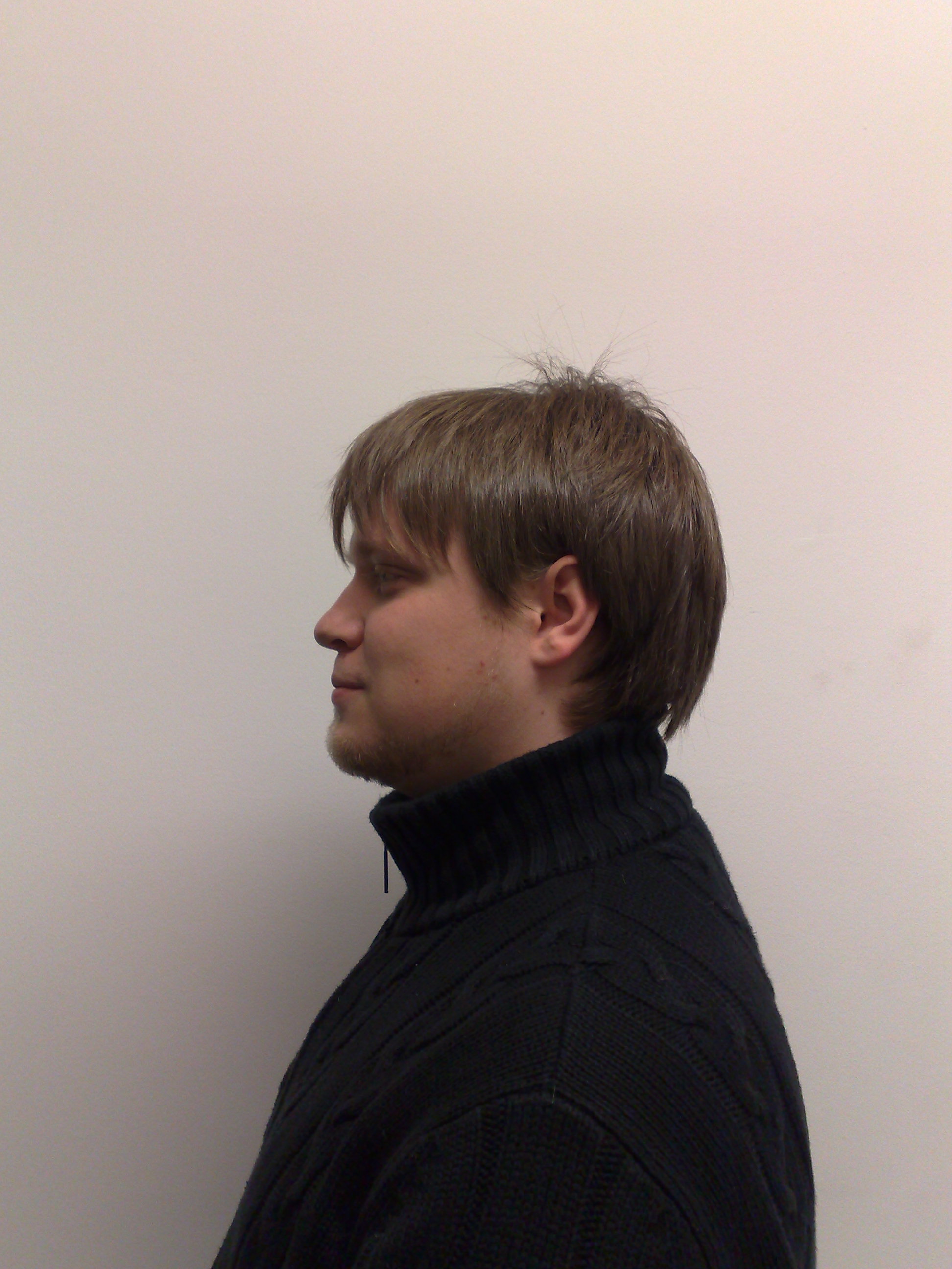 Vorher Links Vorher Links