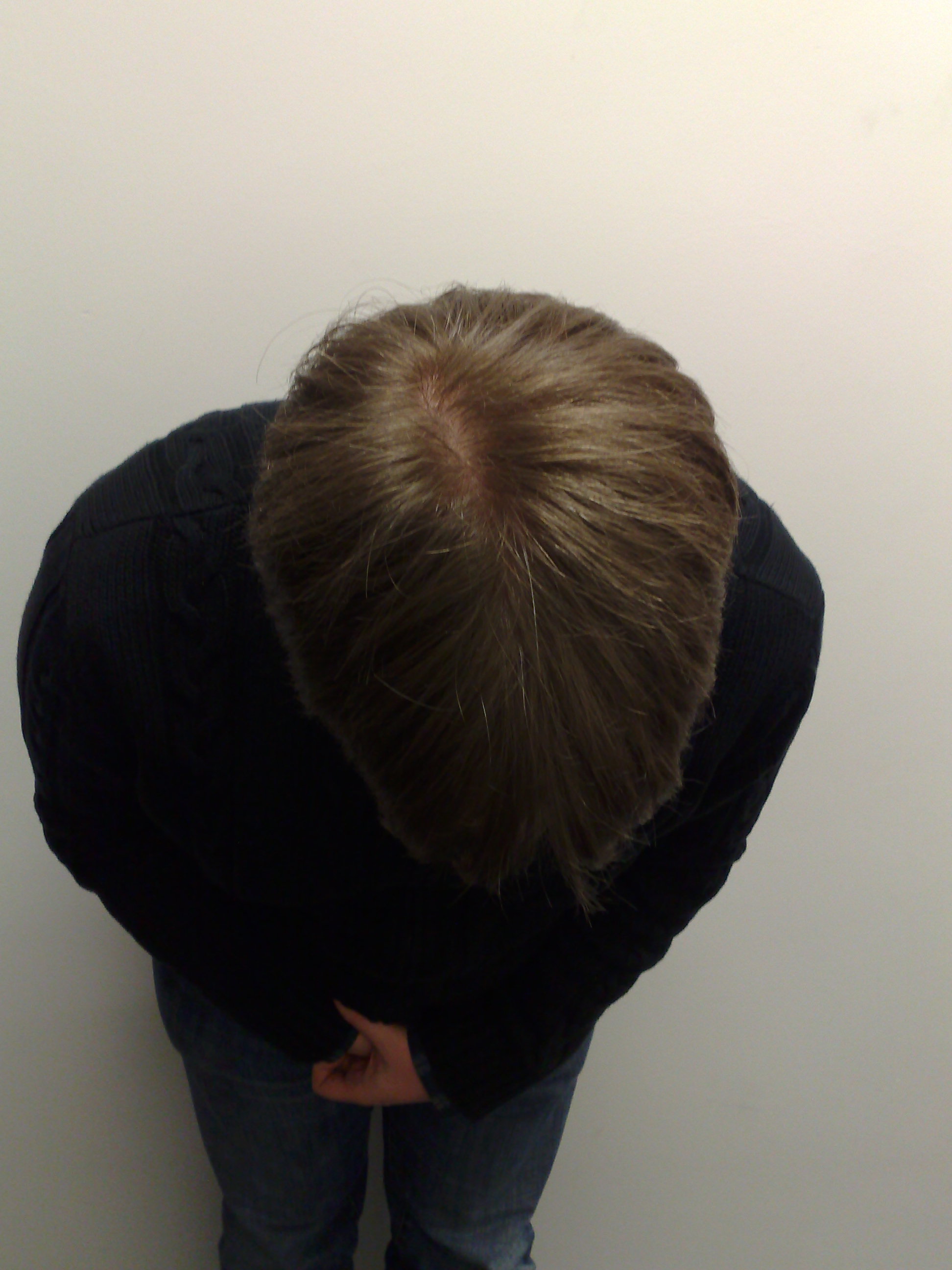 Vorher Oben Vorher Oben