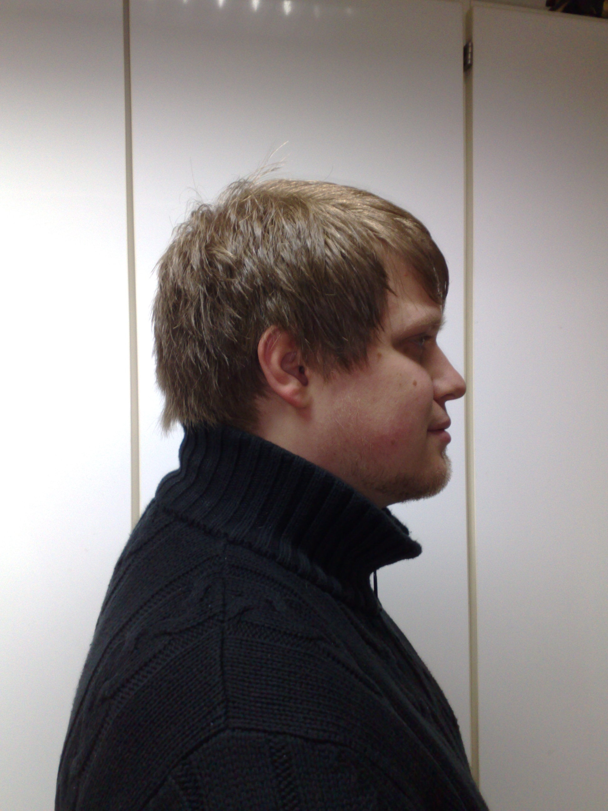 Nachher Rechts Nachher Rechts