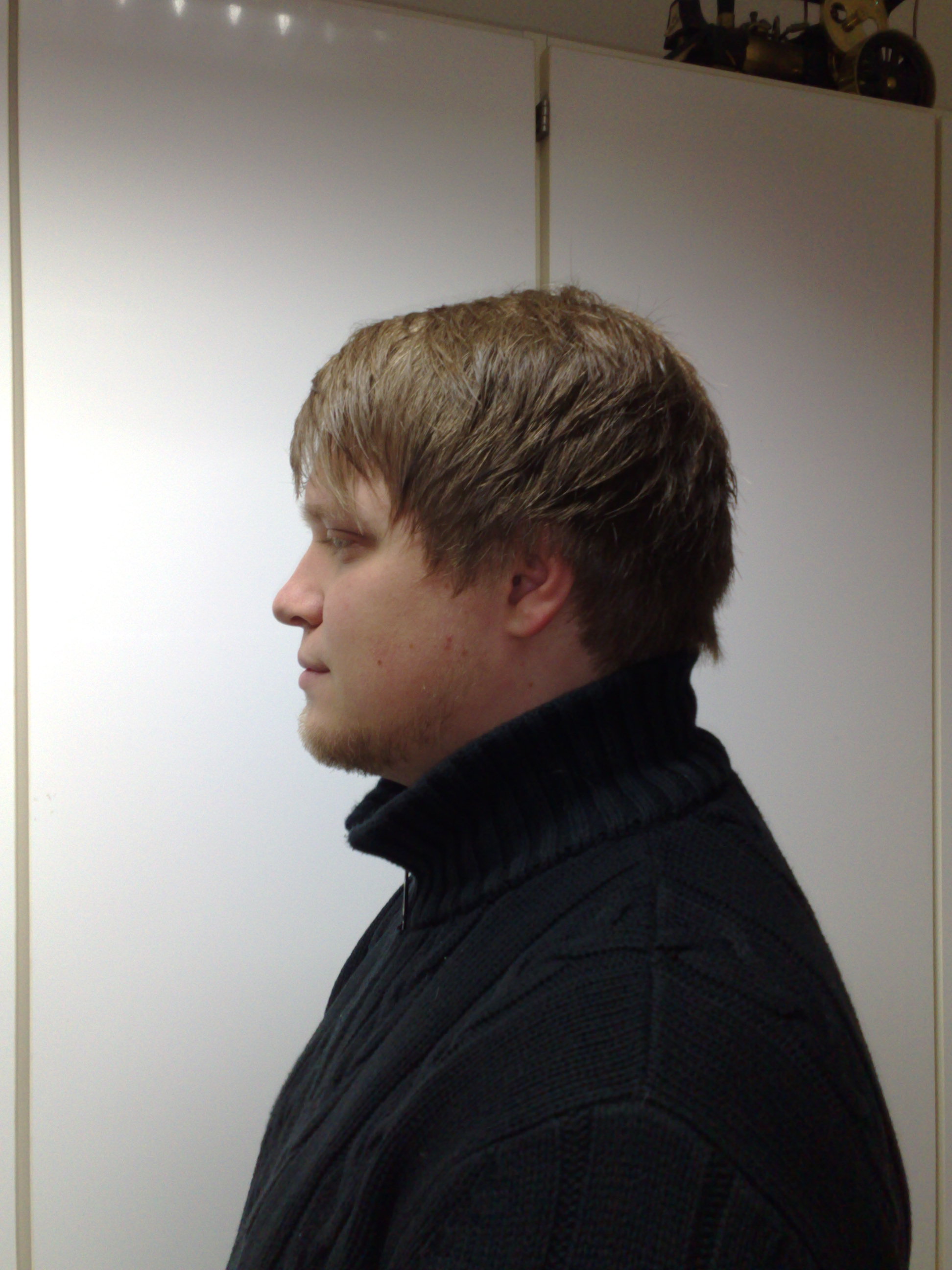 Nachher Links Nachher Links