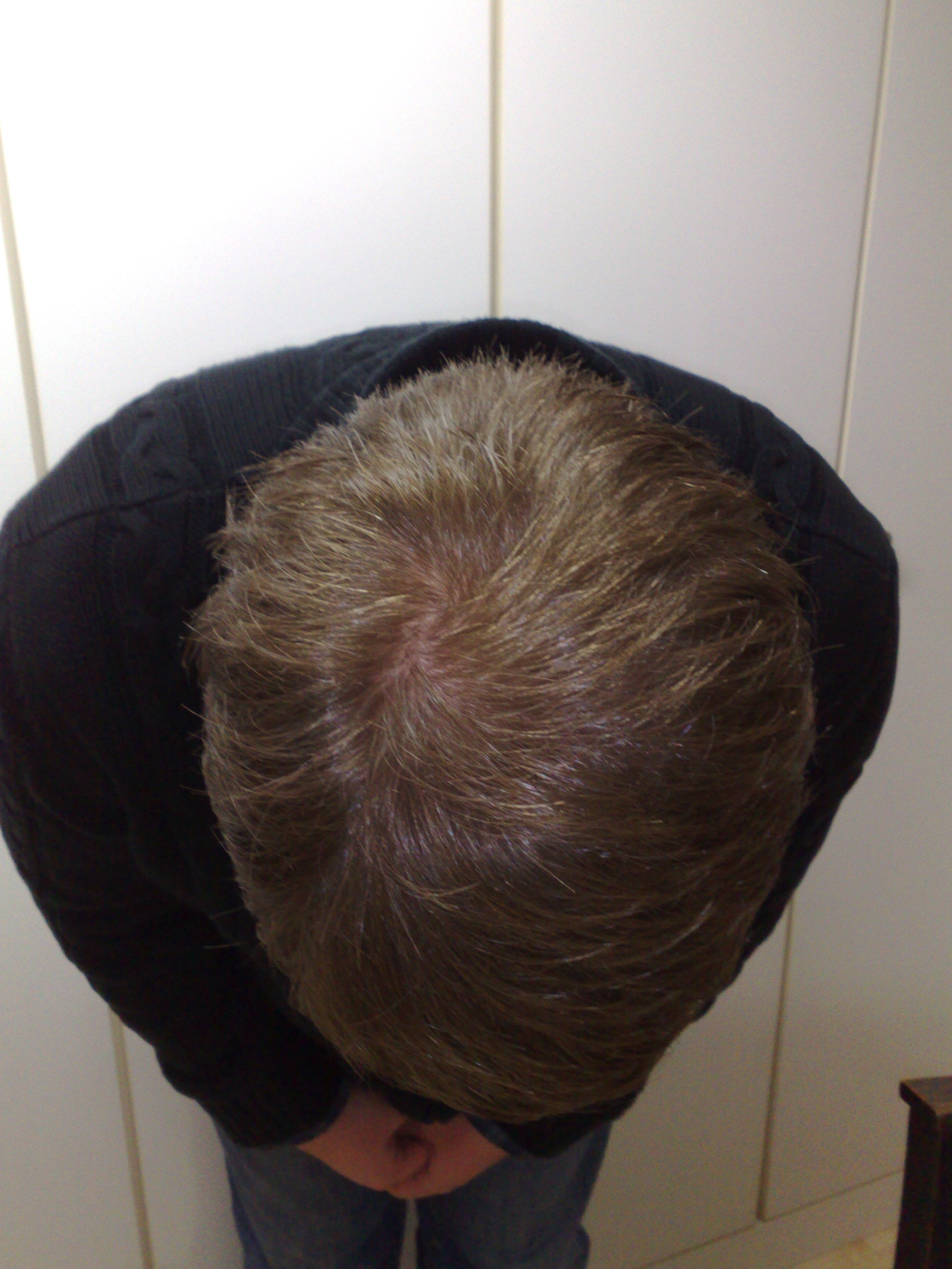 Nachher Oben Nachher Oben